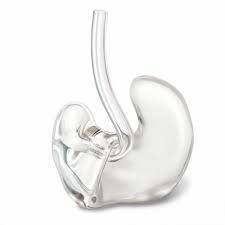 Custom-made Ear Moulds